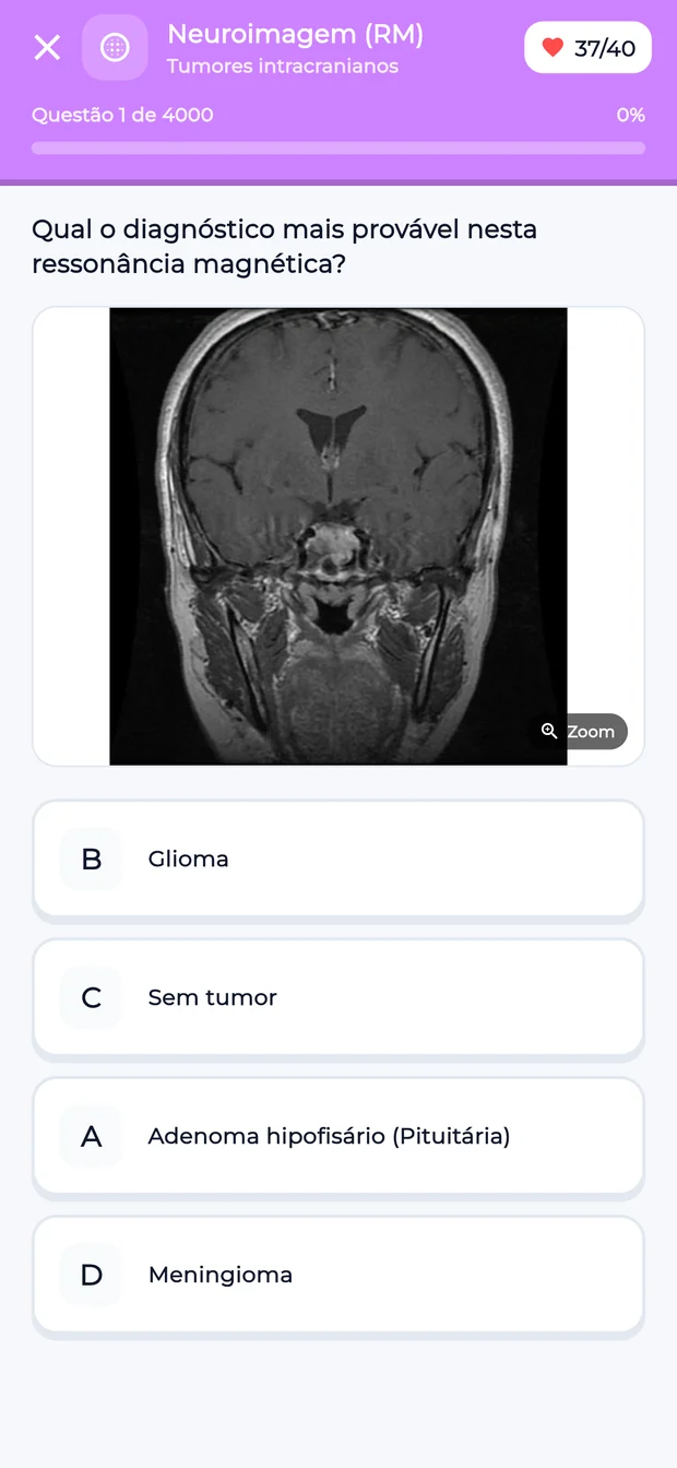 Quiz de imagens: diagnóstico mais provável pelo traçado de ECG
